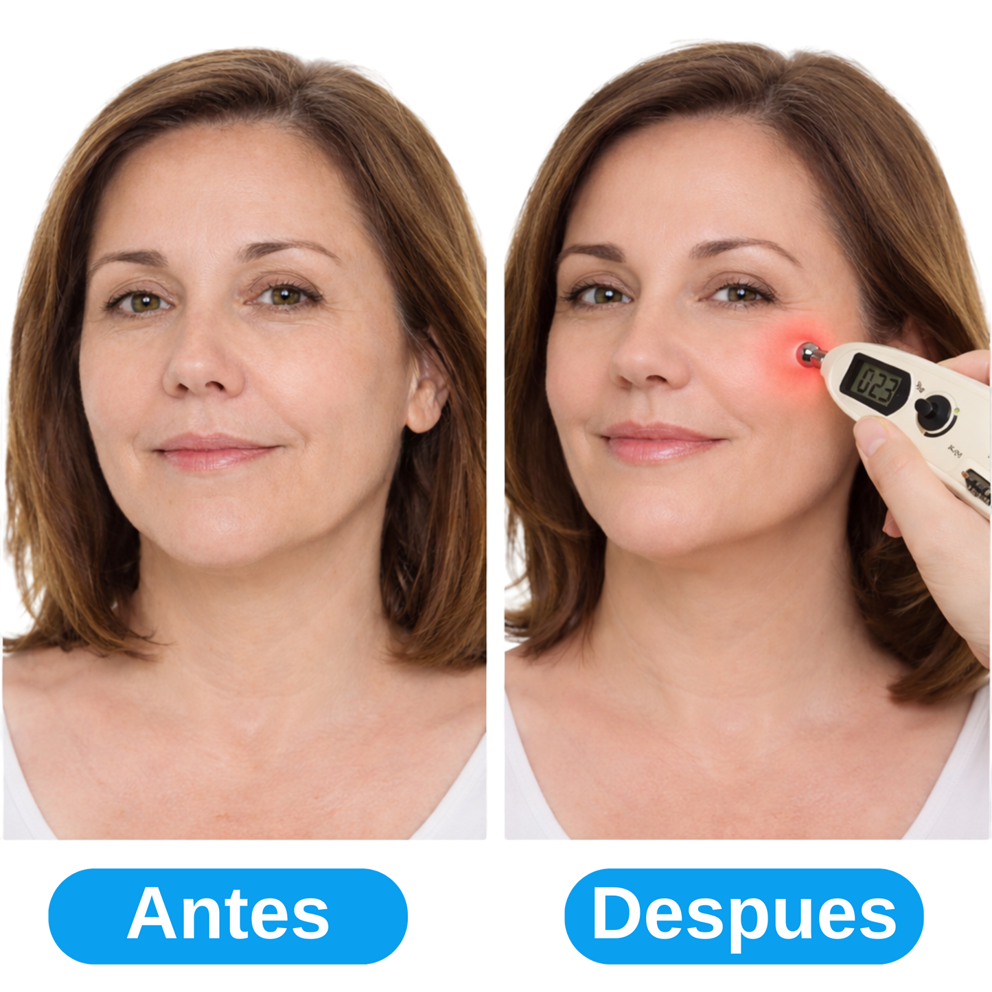 Lápiz Acupuntura Inteligente