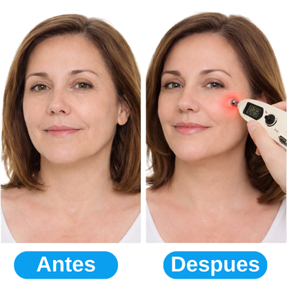 Lápiz Acupuntura Inteligente